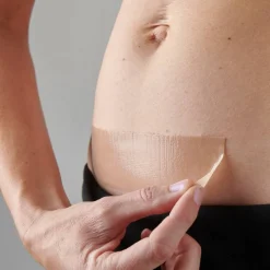 myscar The Active Caesarean Silicone Strips